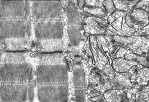 rat | skeletal muscle 6h. post ex. … changes of mitochondrial cristae